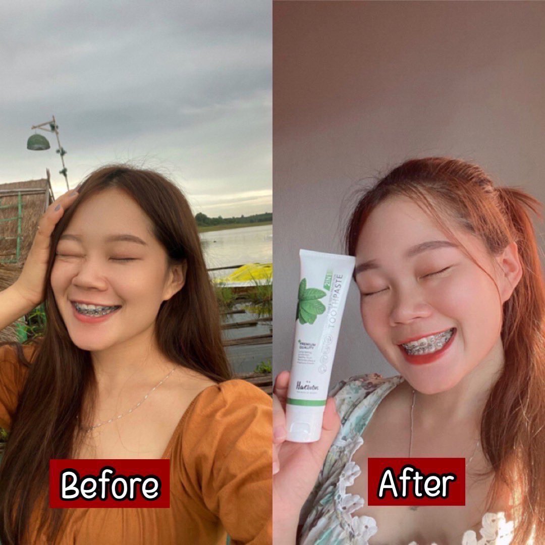 SkinMook's tweet photo. ขอคนละ1รี บอกบุญคนอยากฟันขาว 
สำหรับคนที่จัดฟัน ฟันเป็นคราบเหลือง สียางซีด มีกลิ่นปาก ต้องลองเลยค่าา #ของมันต้องมี #ยาสีฟันแฮวอน
พิกัด📍 https://t.co/VPKBcy06TH https://t.co/sevnZ4Z4x7