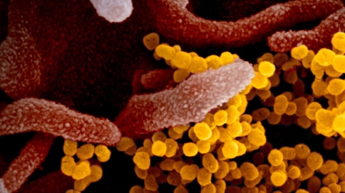 ClearLabsInc's tweet photo. Join us at #aphl2022 for the “Sequencing a Pandemic: How Next-Generation Sequencing Kept Up With The Ever-Evolving #SARSCoV2” session today, 4.15-5.15pm ET, presented by Kyle Rhoden, Director of Product Management of Clear Labs. #ClearDx #LiberateGenomics
https://t.co/G4K0NLhbcE https://t.co/vHa16H2nhH