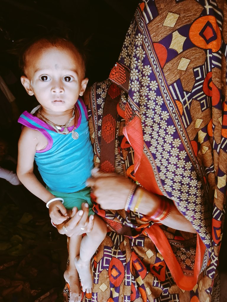 syhoindia's tweet photo. They are in need of constant attention, malnutrition is due to lack of awareness about proper diet for them. #Teamsyho is there to pay attention for them. https://t.co/SVYXwBxXWG