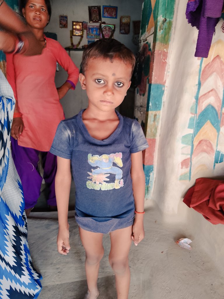 syhoindia's tweet photo. They are in need of constant attention, malnutrition is due to lack of awareness about proper diet for them. #Teamsyho is there to pay attention for them. https://t.co/SVYXwBxXWG