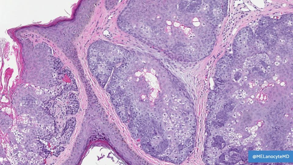 Melanie Bourgeau, MD tweet media