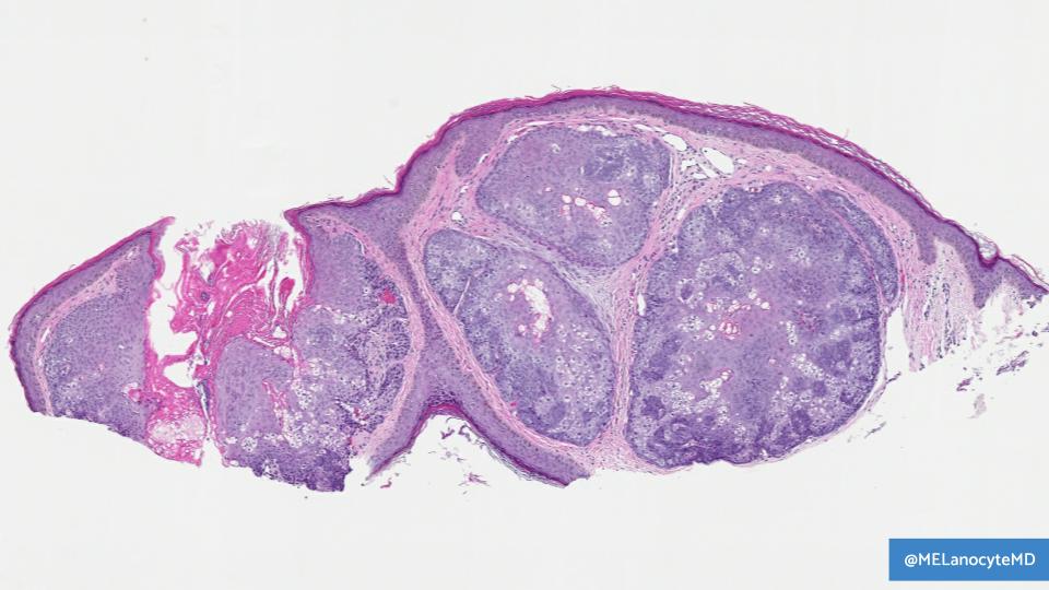 Melanie Bourgeau, MD tweet media