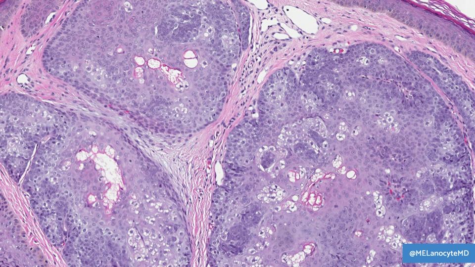 Melanie Bourgeau, MD tweet media