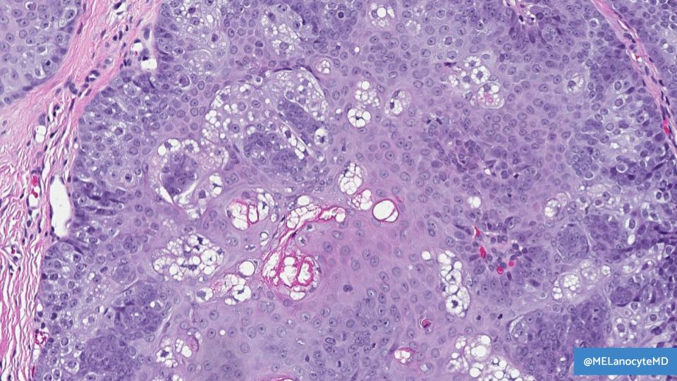 Melanie Bourgeau, MD tweet media