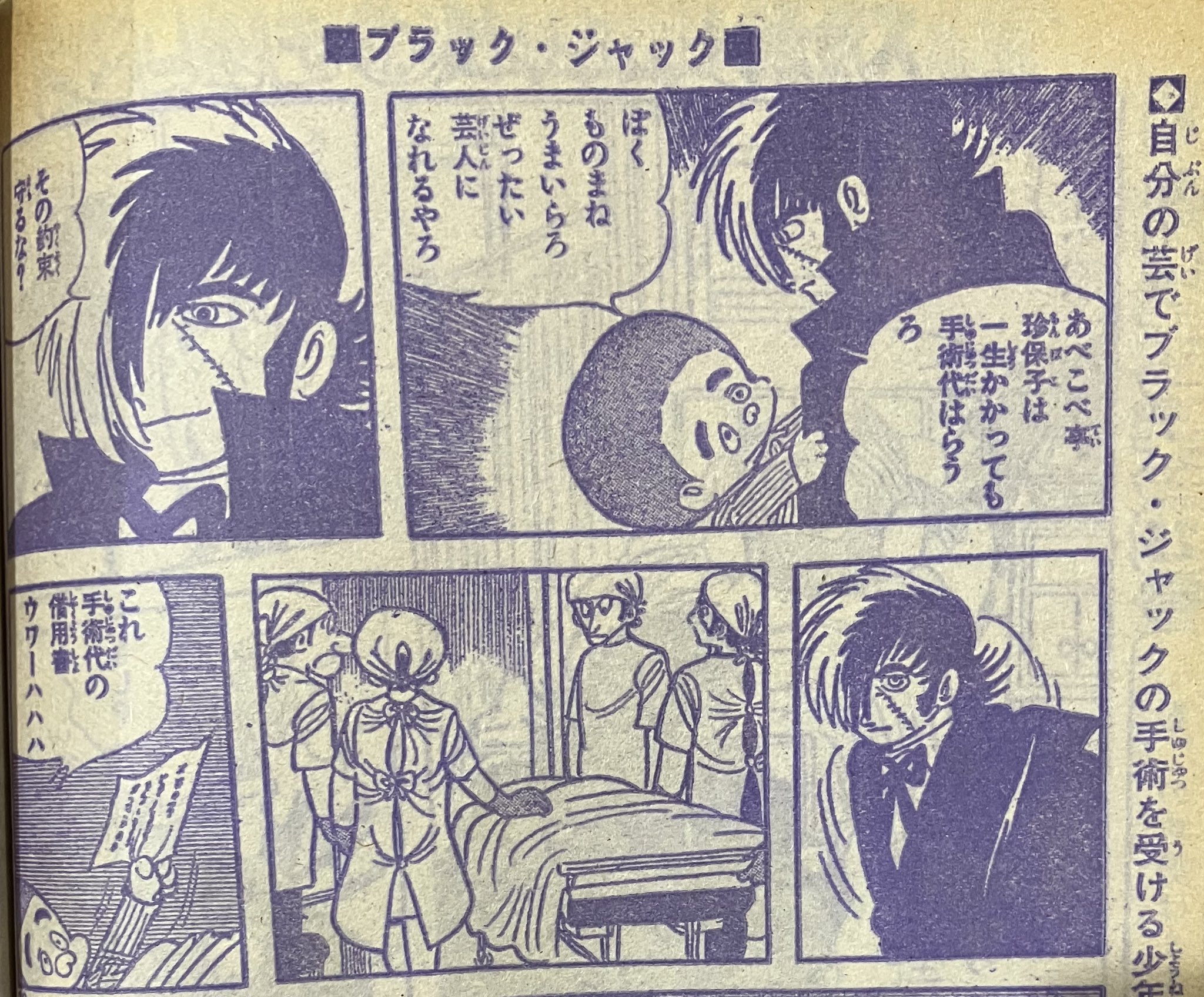 ひら Rt Acky Phoenix 週刊少年チャンピオン 1975年6月9日号です ブラック ジャック は水頭症 すごく辛いお話だからなのかちょっと笑える場面が多く それが重さをさらに助長します でもこのラストは泣けるんです いい芸人になってほしい 漫画