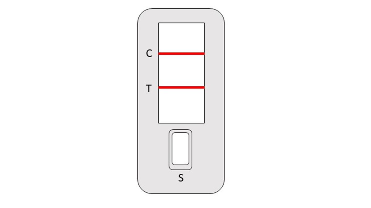 UWSLongCOVID's tweet photo. Have you had #COVID in the past 10 weeks? If you're living in Scotland, help us find out more about how people recover in our latest remote tracking #research study. Please leave your contact details here and a member of the team will be in touch: https://t.co/GQZWwvwqNX https://t.co/v8zphQWVT0