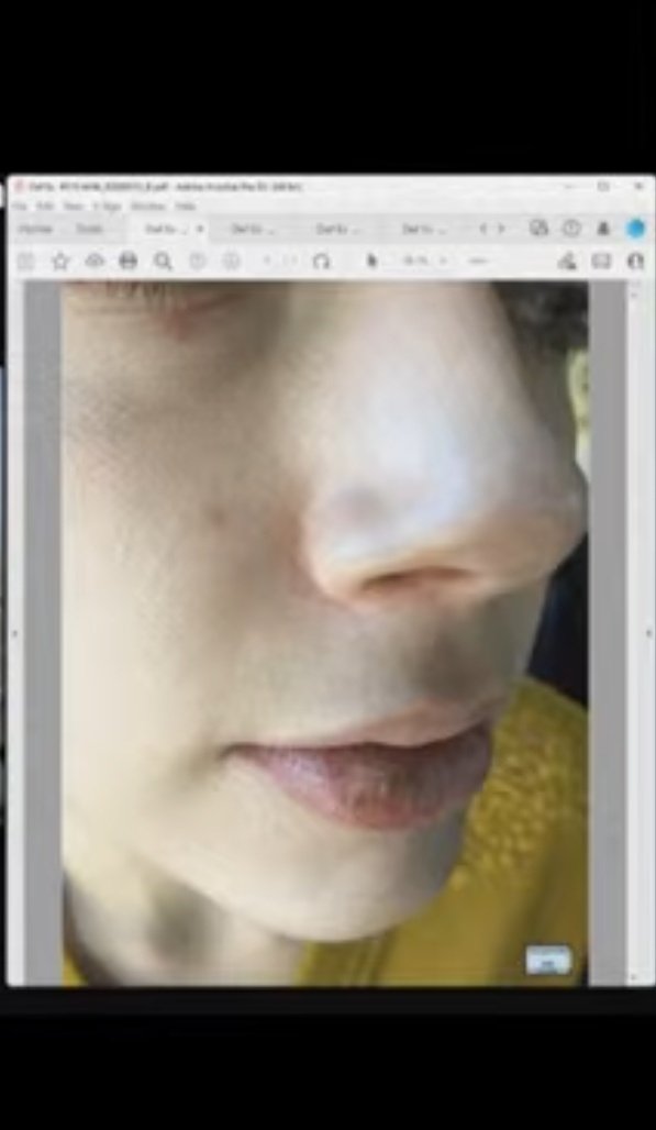 This is meant to be a black eye broken nose and split lip???? Seriously??????#deppvsheardtrial