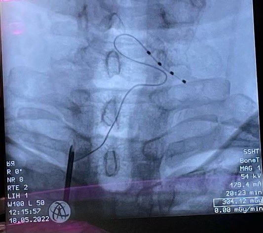 Dr. Mendiola de la Osa tweet media