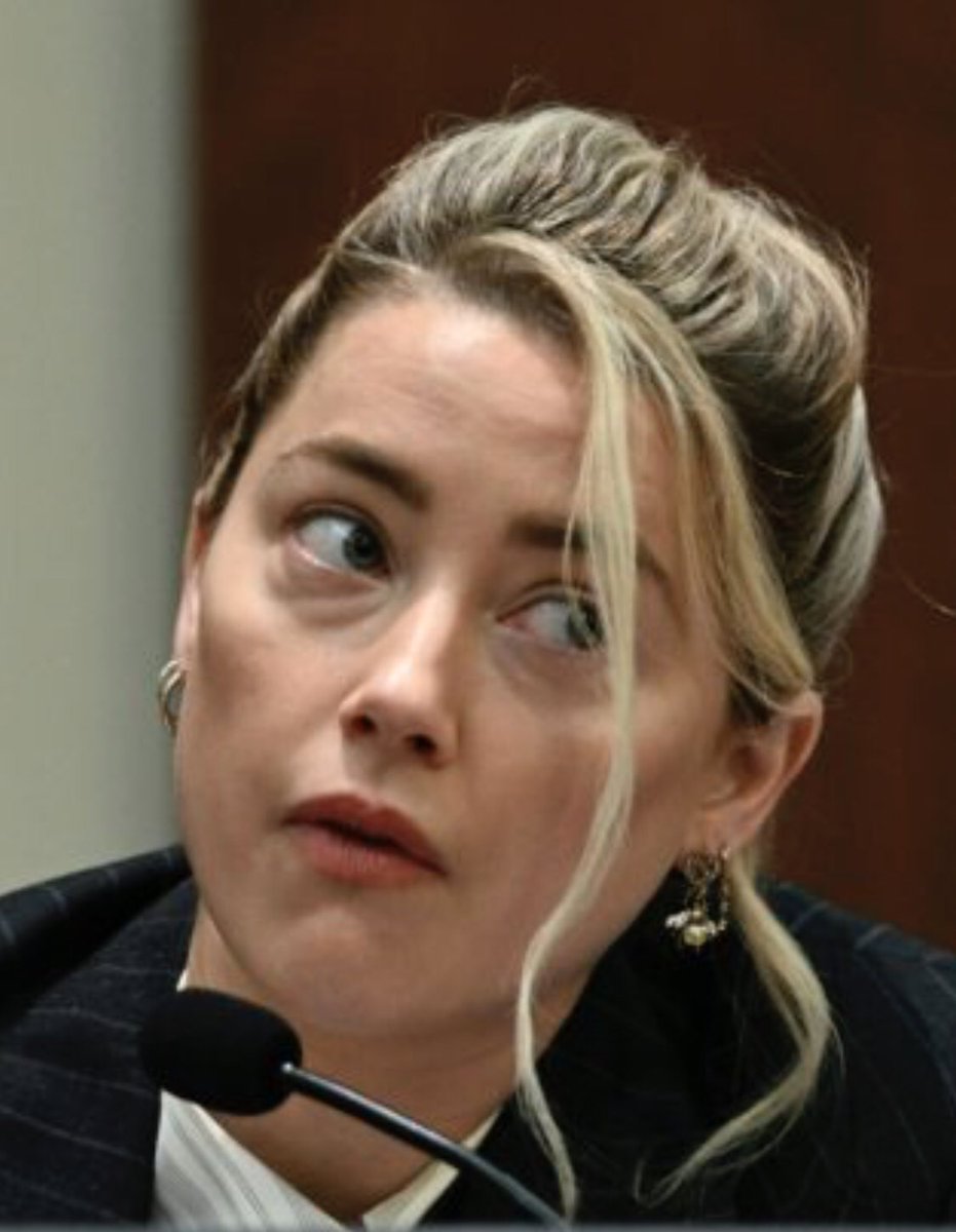 LillyJane916's tweet image. Amber Heard looks more beat up after cross-x w/ Camille than she ever did in the “bruise” photos she took of her alleged “broken”nose &amp;amp;“2 black eyes”

It’s quite easy for her to have dark circles/bags under her eyes…even w/ makeup.

That. Isn’t. Bruising.