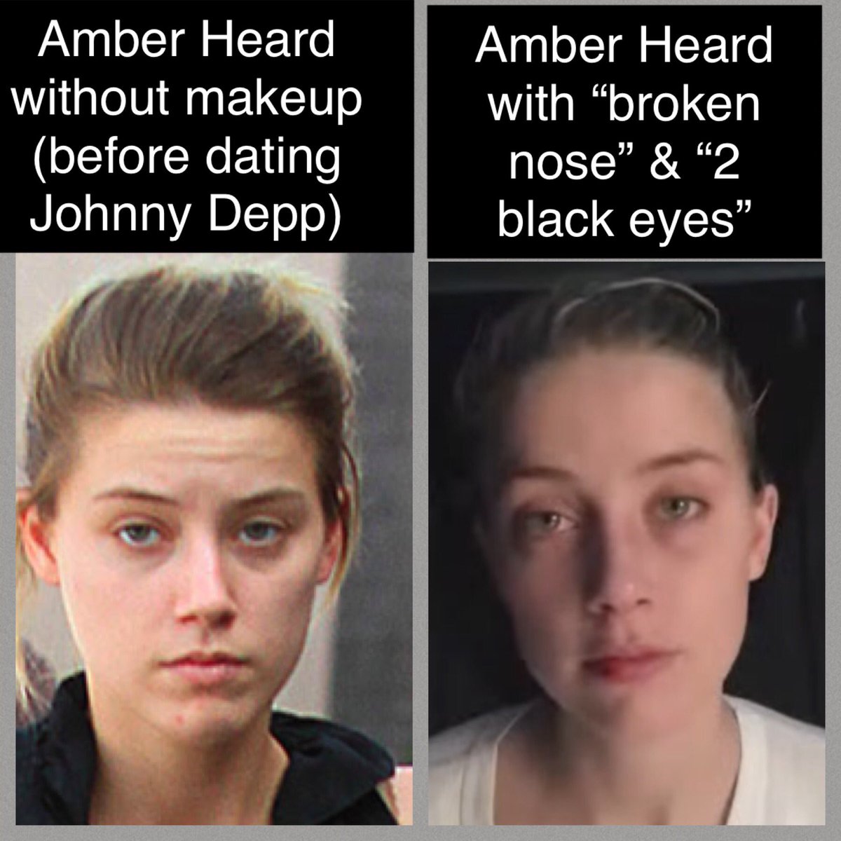 LillyJane916's tweet image. Amber Heard looks more beat up after cross-x w/ Camille than she ever did in the “bruise” photos she took of her alleged “broken”nose &amp;amp;“2 black eyes”

It’s quite easy for her to have dark circles/bags under her eyes…even w/ makeup.

That. Isn’t. Bruising.