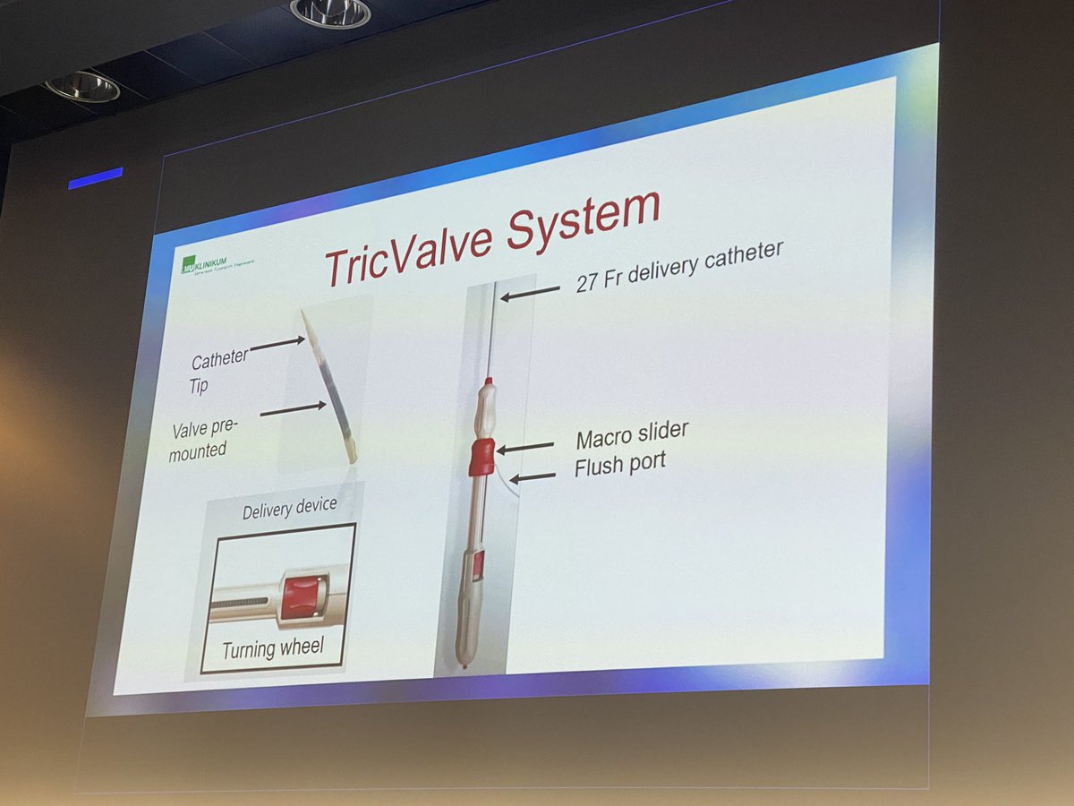 marialtube's tweet photo. Proud and eager for bringing this solution for TR patients to Argentina with @SiprotecSa ! ⬇️🫀#EuroPCR2022 #TricValve https://t.co/bDh93ZdDMg