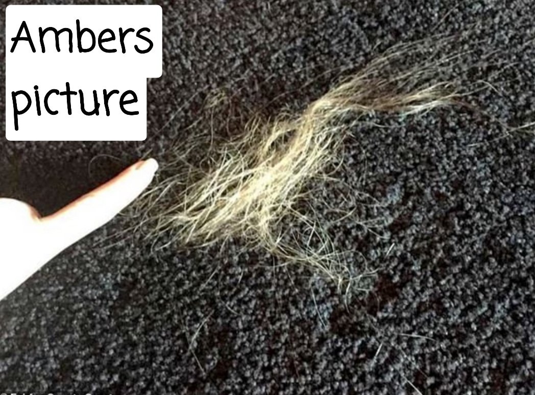 shelldanorissa's tweet image. I HAVE A HUGE PROBLEM WITH THE WHOLE HAIR THING.. HOW IS IT POSSIBLE THE SHORT ALMOST UNHUMAN LOOKING HAIR CAME FROM THE TOP OF THE SCALP? LOOKS LIKE PSORIASIS.. DOES SHE WEAR EXTENTIONS? @courttv @juliegrant #JusticeForJohnnyDeep