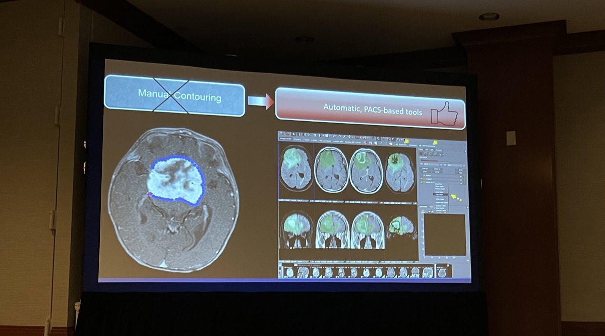 #braintumor scientific session now underway <a href="/TheASNR/">The American Society of Neuroradiology</a> - off to a great start with 2 (!) talks by <a href="/MerkajSara/">Sara Merkaj</a> from <a href="/MariamAboian/">Mariam Aboian</a>’s lab <a href="/YaleRadiology/">Yale Department of Radiology & Biomedical Imaging</a> elegantly demonstrating the value of ML integration in glioma dx and prognostication.