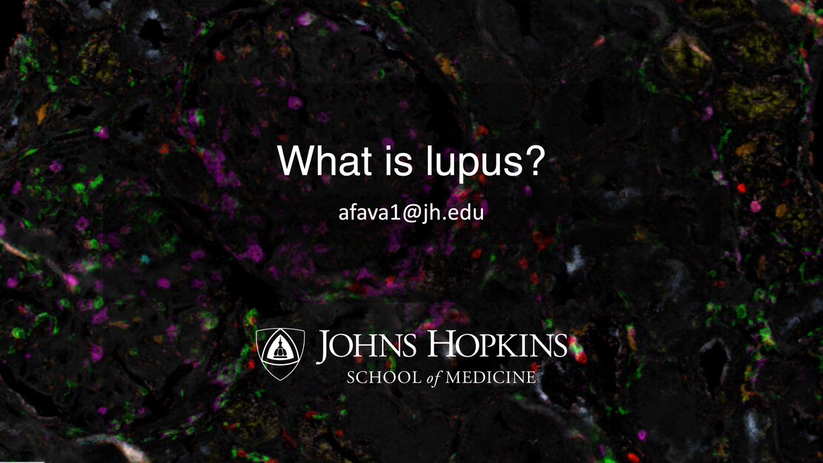 Andrea Fava (@andreafava) on Twitter photo #Hiring Join our research <a href="/HopkinsRheum/">Hopkins Rheumatology</a> to discover new treatments and molecularly redefine kidney #lupus using many omics? Computational only or hybrid with wet lab experience. Fun guaranteed. Physician-scientists most welcome. T32. DM me! <a href="/LupusOrg/">Lupus Foundation of America</a> <a href="/RheumResearch/">Rheumatology Research Foundation</a> #Hiring Join our research <a href="/HopkinsRheum/">Hopkins Rheumatology</a> to discover new treatments and molecularly redefine kidney #lupus using many omics? Computational only or hybrid with wet lab experience. Fun guaranteed. Physician-scientists most welcome. T32. DM me! <a href="/LupusOrg/">Lupus Foundation of America</a> <a href="/RheumResearch/">Rheumatology Research Foundation</a>