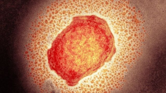 Madrid detecta 23 posibles casos de viruela del mono. 
Tras la alerta esta mañana de 8 casos sospechosos, la región ha comunicado la nueva cifra. La alerta ha saltado días después de que Reino Unido notificara la detección de 7 casos.