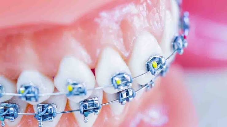 Infantident tweet picture