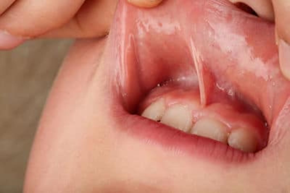 Infantident tweet picture