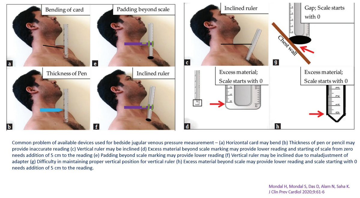Do you properly measure JVP like this [or using similar instrument(s)] in routine clinical practice?...