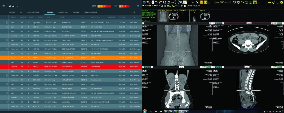 KonicaMinoltaMI's tweet photo. Exa® Lite PACS is built on the proven Exa Platform for fast access to images from any device scaled and tailored to meet the needs of hospitals, clinics and imaging centers in Latin America. #Radiology #DiagnosticImaging #Radiologists #X-ray #HCIT #PACS #EXALite https://t.co/fE7v8KJPDJ