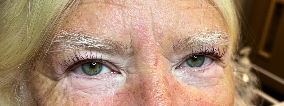 ally_esthetics's tweet photo. Want lash extensions? Book with me! We have Classics available for $65, with 50% off your first service with me!! So that’s a full set for $32.50!! Available Mon-Thursday 1:30pm or Friday 9am,1:30pm
#lashextenstions #lashes #Denton #DentonTx https://t.co/WsMgiaWVtB