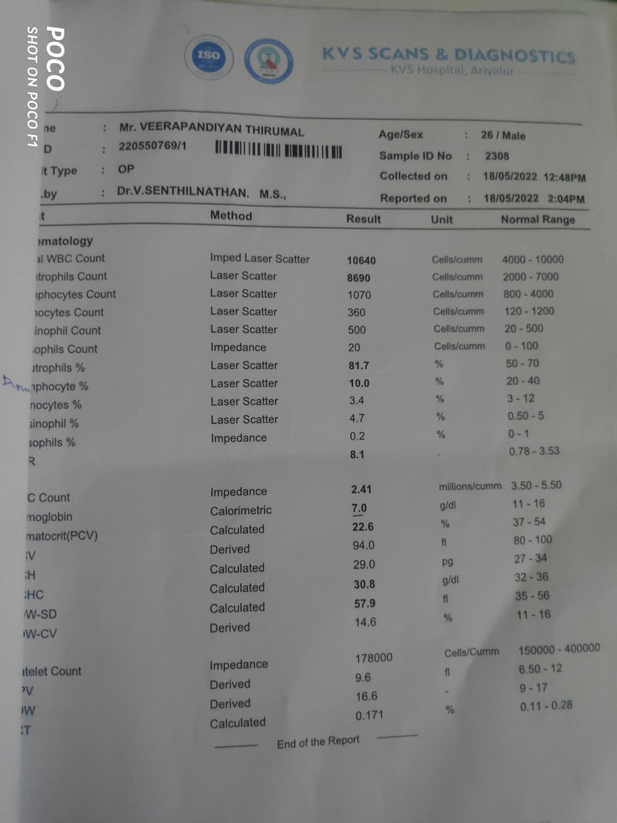 Itz_Veera_Off's tweet image. Hi Friends.....

Naa Konjam Pesuran Kelunga ...

Romba Naa Online Varala Some Problem
Kidney Poiduchi I Mean Small Agiduchi Atha
Sari Panna Mudiyathunu Sollitanga Vazha Naal 
Muzhukka Naa Dialysis Pannanum nu Sollitanga......