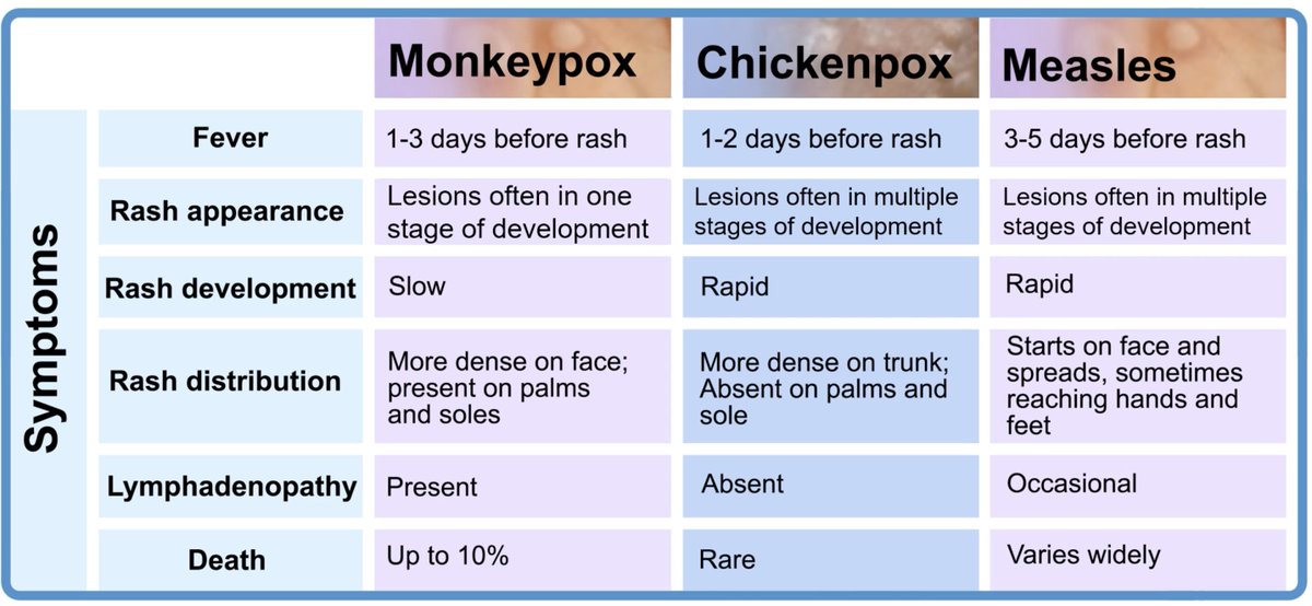 zchagla's tweet image. A very good resource for front line clinicians from the @WHO modules for monkeypox.