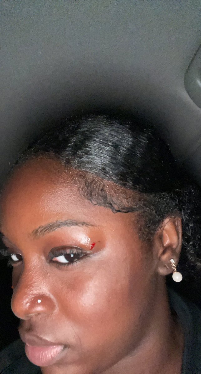 noelsidem's tweet photo. First concussion. March 18th. Eastern Hemisphere. Age 17. Weight: idk im concussed. Height. Idk. 8:43:32pm.  Venmo Noella-Idem. https://t.co/PG4SNSlXCL