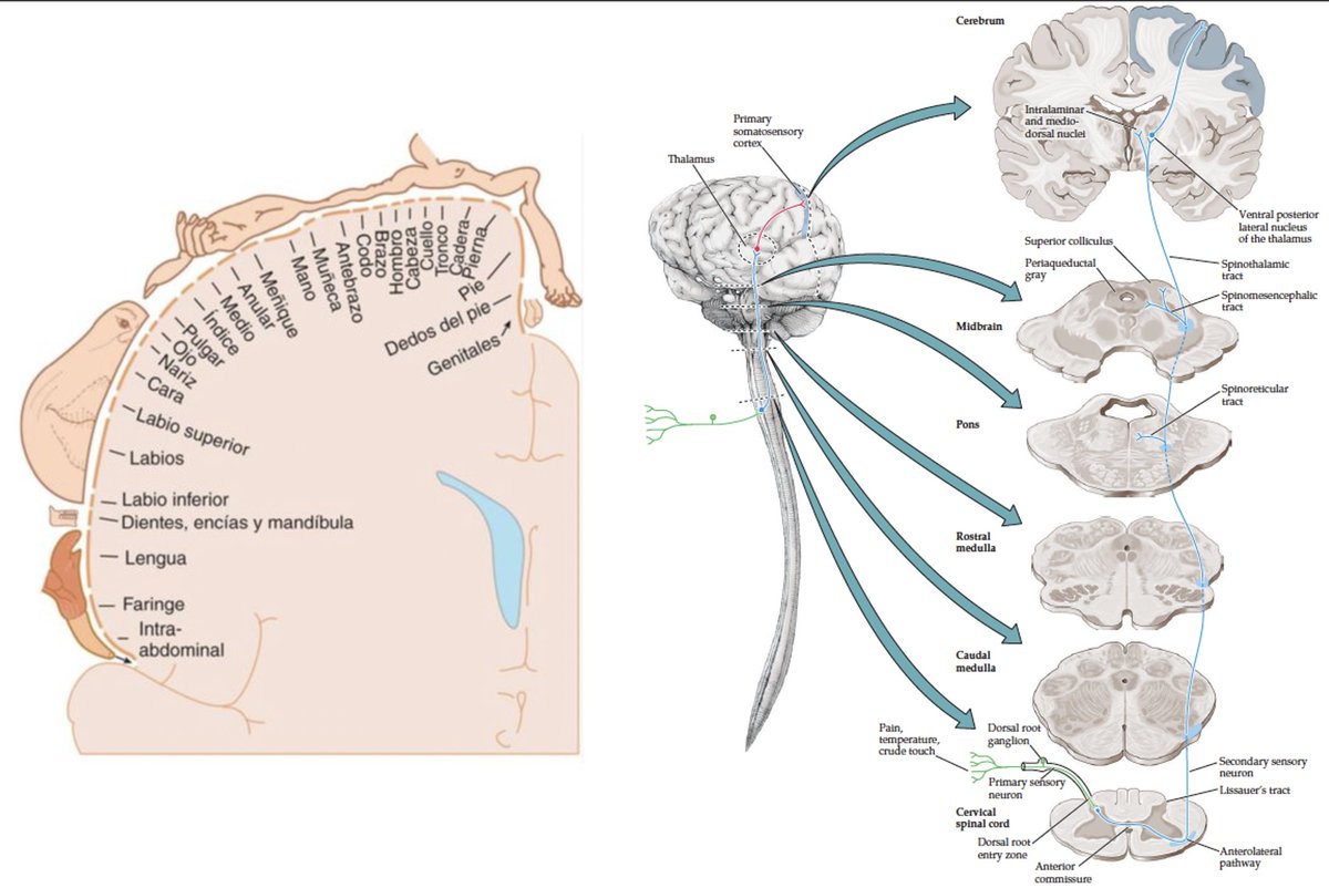 KrizLohman's tweet photo. 🧠Vía Espinotalámica - Dolor, temperatura, tacto crudo
✅Terminaciones libres
✅Fibras Aδ y C
✅Asta Dorsal - Lamina 1
✅Decusa - Comisura Anterior, 2-3 segmentos ⬆️
✅Haz Espinotalámico Ant. y Lat.
✅N. Ventral Posterolateral - Tálamo
✅Corteza Somatosensorial Primaria https://t.co/3dMwSkApnS