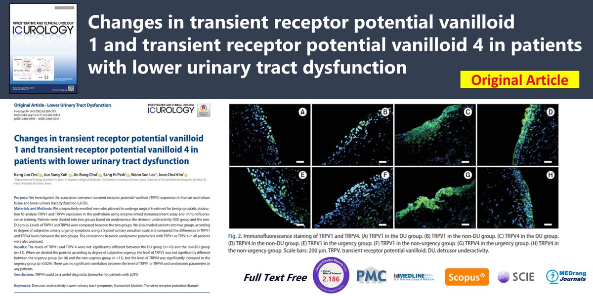 icurology's tweet photo. Changes in transient receptor potential vanilloid 1 and
transient receptor potential vanilloid 4 in patients
with lower urinary tract dysfunction
🌷https://t.co/2HvcJI2UzC
2022 May;63(3)Kang Jun Cho
#Detrusor_underactivity #Lower_urinary_tract_symptoms
#Overactive_bladder https://t.co/fZAXgY4wDA