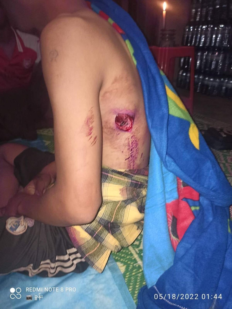IrrawaddyNews's tweet photo. Myanmar junta fired artillery into Lwal Pan Sane village–locates in the middle of Mobye reservoir–in Pekon, southern Shan State on Tuesday night, injuring two men in the monastery. The grenade also damaged civilian homes and a school.

(Photo: Pekon PDF) #WhatsHappeningInMyanmar https://t.co/bbVaI1aCb1