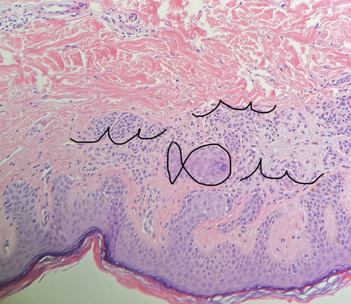 One fish, two fish, red fish, blue fish. Anyone else remember that book or read it their kids? More path-related than I imagined 🤪 #dermpath