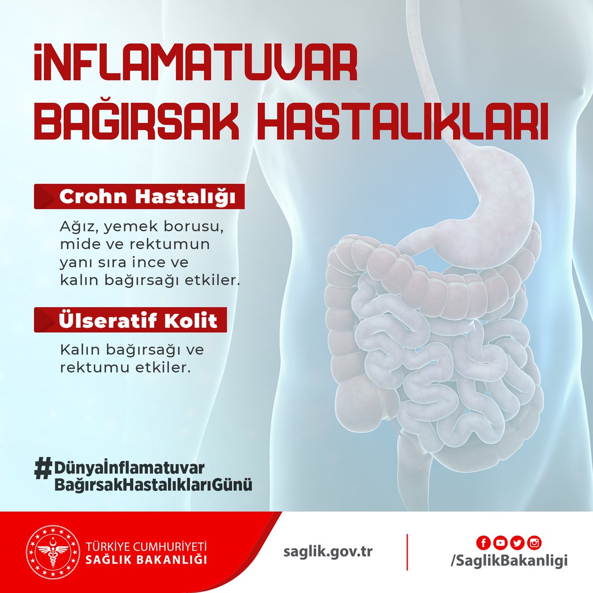 saglikbakanligi's tweet photo. İNFLAMATUVAR BAĞIRSAK HASTALIKLARI
- Crohn Hastalığı
Ağız, yemek borusu, mide ve rektumun yanı sıra ince ve kalın bağırsağı etkiler.
- Ülseratif Kolit
Kalın bağırsağı ve rektumu etkiler.
#DünyaİnflamatuvarBağırsakHastalıklarıGünü https://t.co/X3Plci5Juf
