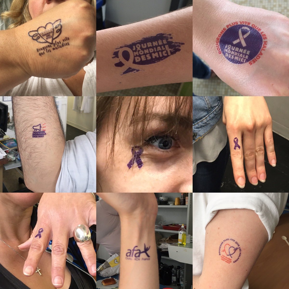 malvynederkind1's tweet photo. @afaCrohnRCH TENS recherche pour les patients MICI @TENS_lab @mibiogate @Inserm @FacSciencesNtes https://t.co/z4UwDOfYC7