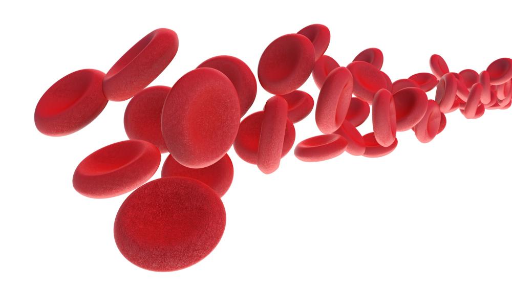 BiIndia's tweet photo. #Aneamia is a health condition wherein the body lacks healthy red blood cells to carry adequate oxygen, causing fatigue and a weak immune system. It makes an individual more prone to infections - and in children, it affects their physical and cognitive development. https://t.co/Be0c6ZlT0w