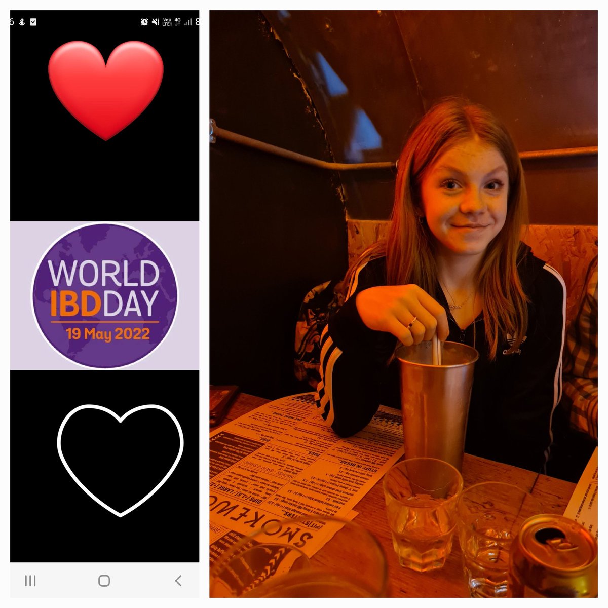 Always smiling #crohns #WorldIBDDay