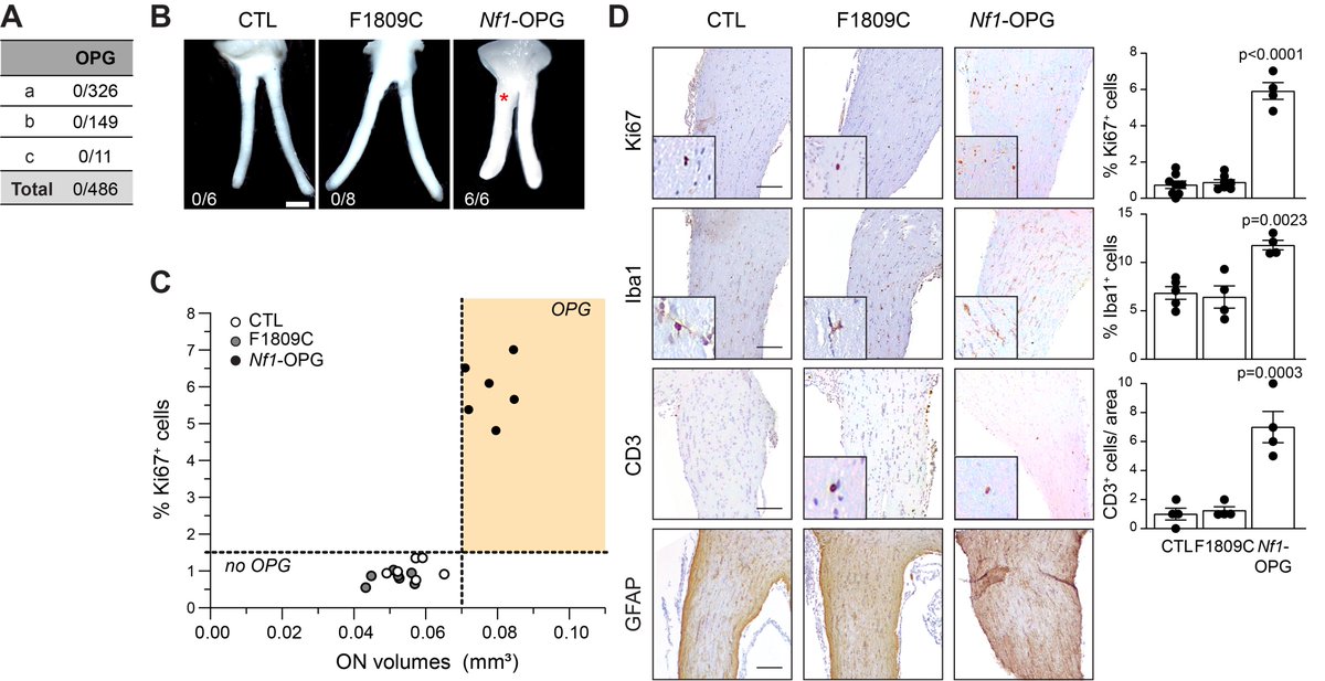 GutmannLab's tweet photo. We are excited to share our latest #research on #cancerneuroscience, published with @SpringerNature in @NatureComms, in collaboration with our amazing colleagues, @michelle_monje, @YuanPan3, and Dr. Lu Le.

https://t.co/4bFlm8FRyG https://t.co/KSPEgUObrz