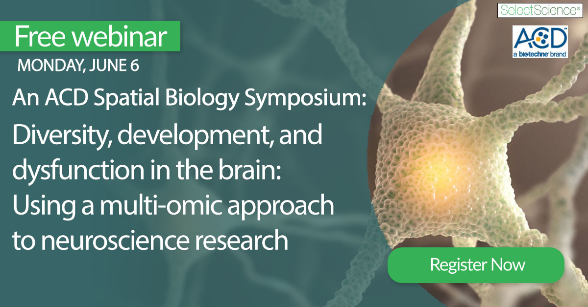 SelectScience's tweet photo. Diversity, development & dysfunction in the brain: Join us for this live event to hear about the innovative research of three neuroscientists who leverage multi-omic technologies to provide insight to complex pathways and disease models. https://t.co/eRjJv5dPoX https://t.co/jsQKwOu7mC