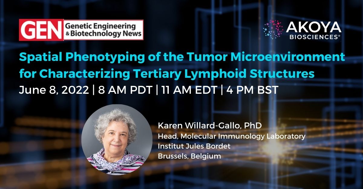 AkoyaBio's tweet photo. Mark your calendars on June 8th for this @GENbio webinar to hear Dr. Karen Willard-Gallo share her study findings on tertiary lymphoid structures, T follicular helper cells, and B cells in human #breastcancer. https://t.co/hrqu0Dfwk0

#multiplex #spatialbiology #GENbio https://t.co/UjH6oFnOft