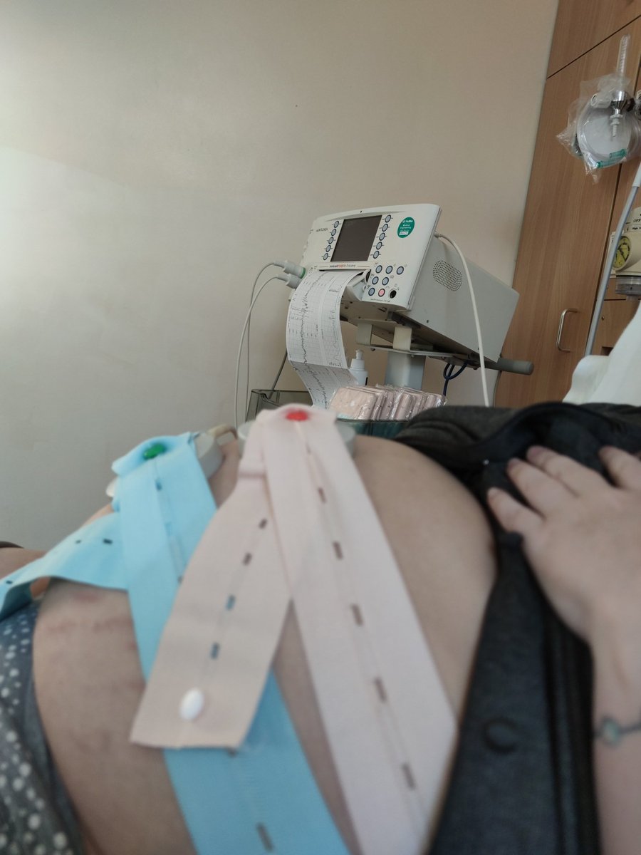 gingfuzz's tweet photo. @NVIDIAGFN Hospital while wifey is lying on the bed having contractions for the new born soon to arrive. https://t.co/tmYbfBfZNh