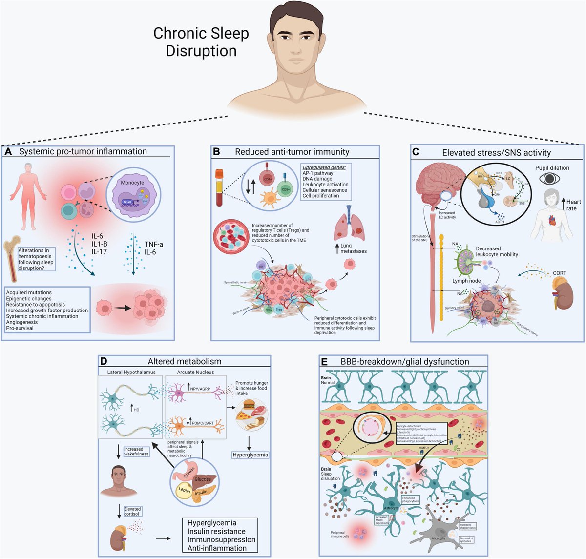 Does sleep disruption promote cancer or does cancer reciprocally disrupt sleep? A new review discusses existing evidence for both hypotheses and presents a framework into the link between #sleep and #cancer. Read: bit.ly/3LtSrwl