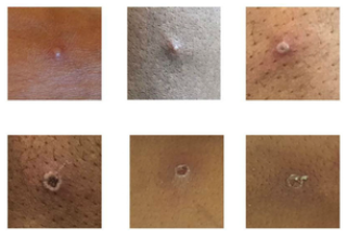 Monkeypox is affecting gay men in London.
We’re running at reduced capacity.
Please don’t walk in without calling us first.
More info about monkeypox here
dean.st/health-amp-wel…