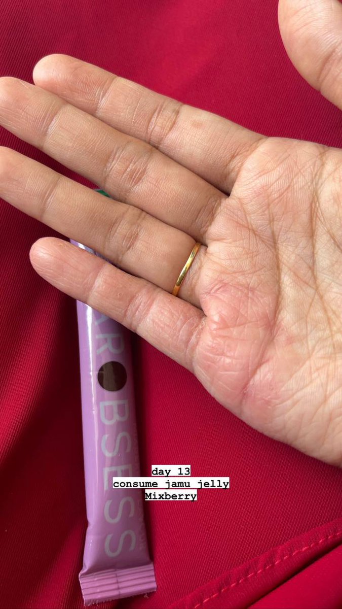 Tak sangka Mixberry Jelly boleh rawat eczema i ni dalam seminggu je dah back to normal 🫶🏻🥹

   From this                To this

shp.ee/q2t4ptm