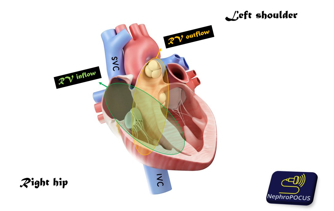 NephroP's tweet photo. #POCUS image acquisition is all about knowing the #anatomy 
🔗https://t.co/ZMXkIa9G5k
Think of probe as a flashlight 🔦and search for relevant structures! https://t.co/gViH5SizoO