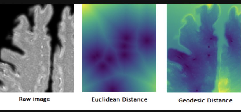 Why/When you should consider geodesic distance for data visualization and dimensionality reduction?

My article in <a href="/TDataScience/">Towards Data Science</a> explains Isometric Mapping(ISOMAP), and includes interpretation of the visualized dataset that reduced dimensionality by ISOMAP towardsdatascience.com/preserving-geo…