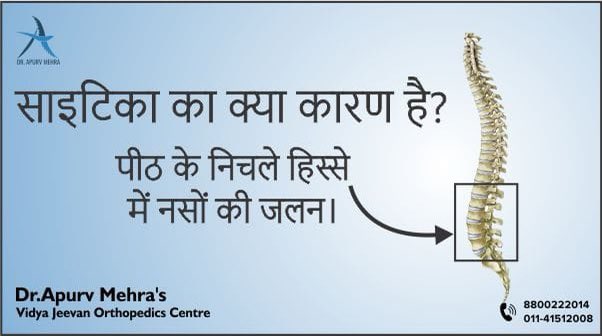 ApurvDr's tweet photo. साइटिका (sciatica) का दर्द कमर से आने वाली नस के दबाव या जलन की वजह से पीठ के निचले हिस्से से कूल्हों और पैर के नीचे होता है। यह आमतौर पर शरीर के एक तरफ को प्रभावित करता है। यह तब होता है जब रीढ़ की हड्डी का रास्ता कम हो जाता है जिससे नस पर दबाव बढ़ जाता है। https://t.co/rmhCSTAWeD