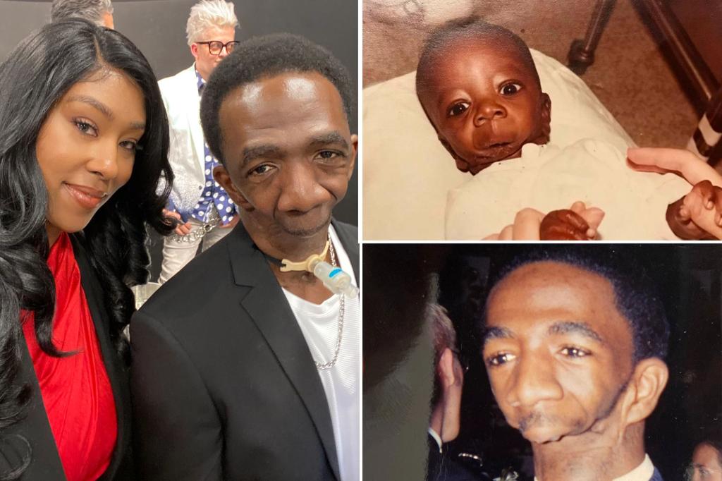 New York Post on Twitter: "Man born without a jaw finds love after