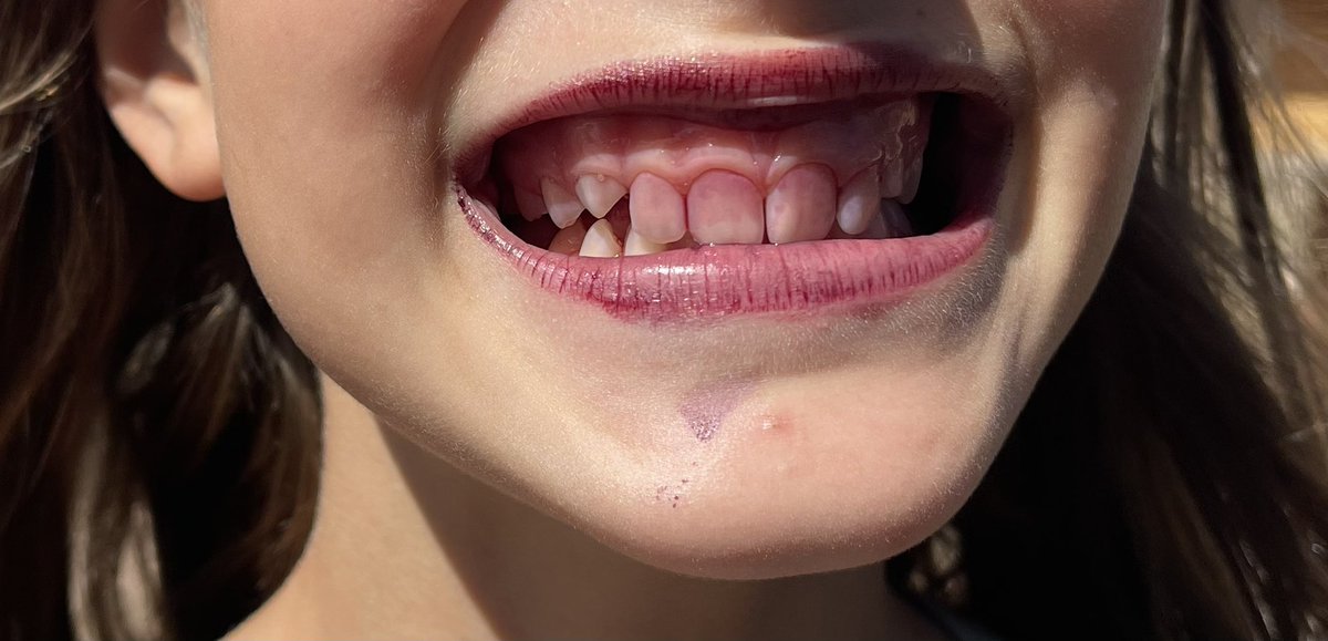 It’s mulberry season and the students are definitely enjoying the harvest! <a href="/LavalandES/">Lavaland Elementary</a>