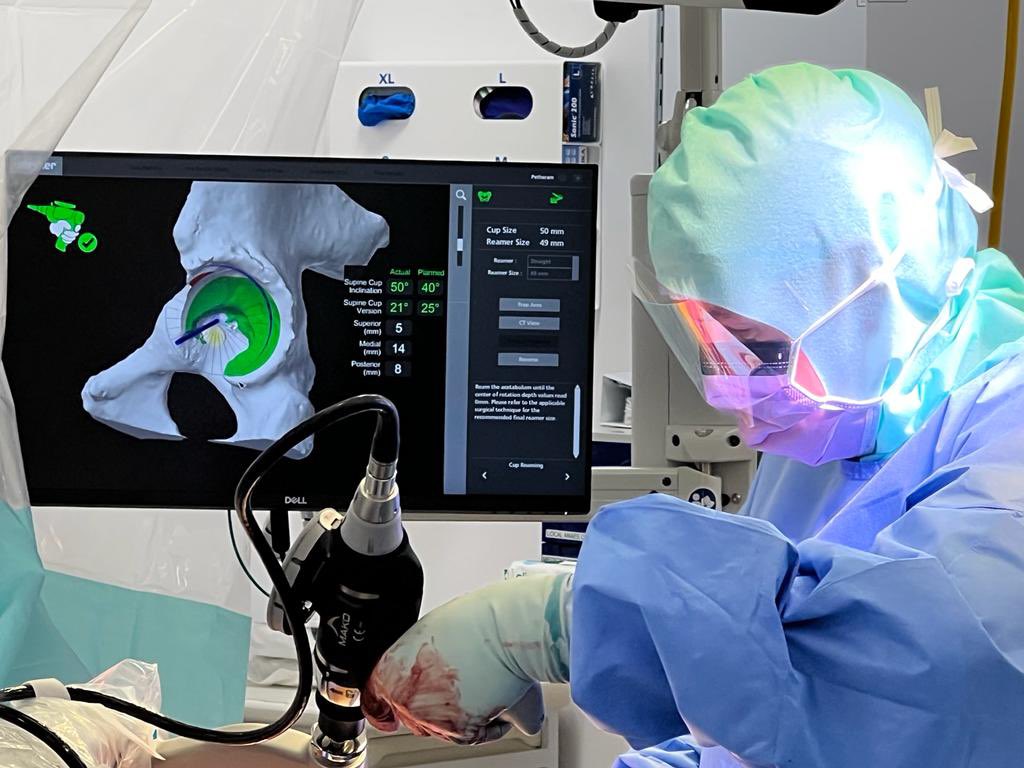 Tim (@timpetheram) on Twitter photo That’s the first patient entered into <a href="/RACERTrials/">RACER Trials</a> #RACERHip yesterday. Look forward to contributing many more with the team <a href="/NorthumbriaOrth/">Northumbria Orthopaedics</a> #evidence #hipreplacement Is #MAKO robotic hip clinically and cost effective? <a href="/pdhwall/">Peter Wall</a> That’s the first patient entered into <a href="/RACERTrials/">RACER Trials</a> #RACERHip yesterday. Look forward to contributing many more with the team <a href="/NorthumbriaOrth/">Northumbria Orthopaedics</a> #evidence #hipreplacement Is #MAKO robotic hip clinically and cost effective? <a href="/pdhwall/">Peter Wall</a>