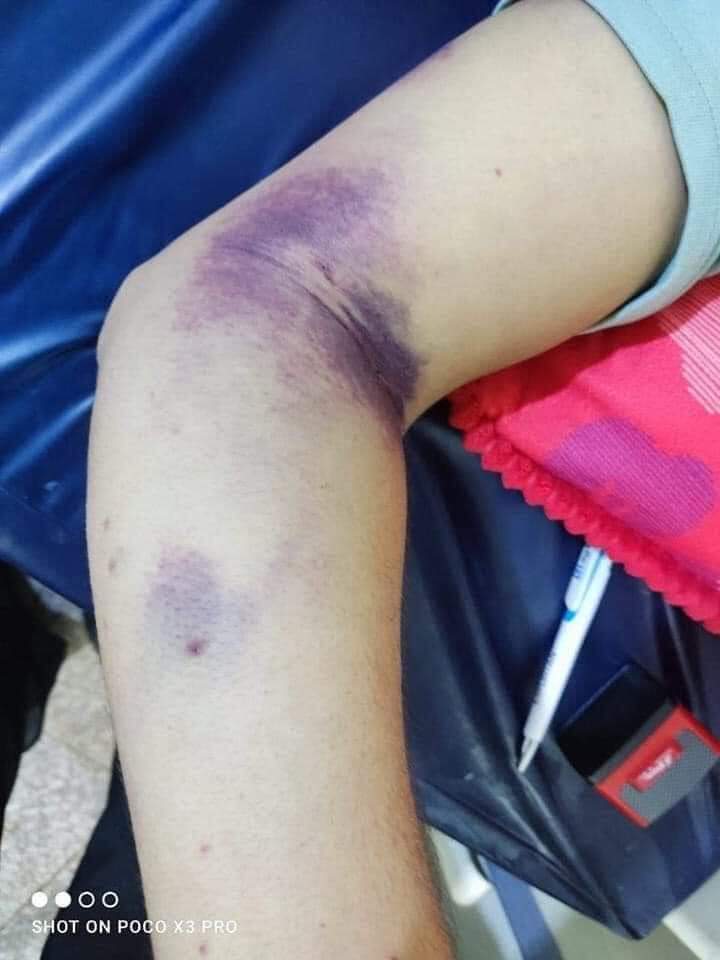 hibafathel's tweet photo. قانون التدرج الطبي البيطري المعدل لسنة 2021 حق للاطباء البيطريين و واجب التطبيق باقصى سرعة رفد المؤسسات الطبية البيطرية بالنقص الكبير الحاصل نتيجة الى عدم تطبيق القانون منذ عام ١٩٨٩ و احالة 
اعداد كبيرة الى التقاعد 

#التويتر_بيطري https://t.co/D4f31X9xnQ