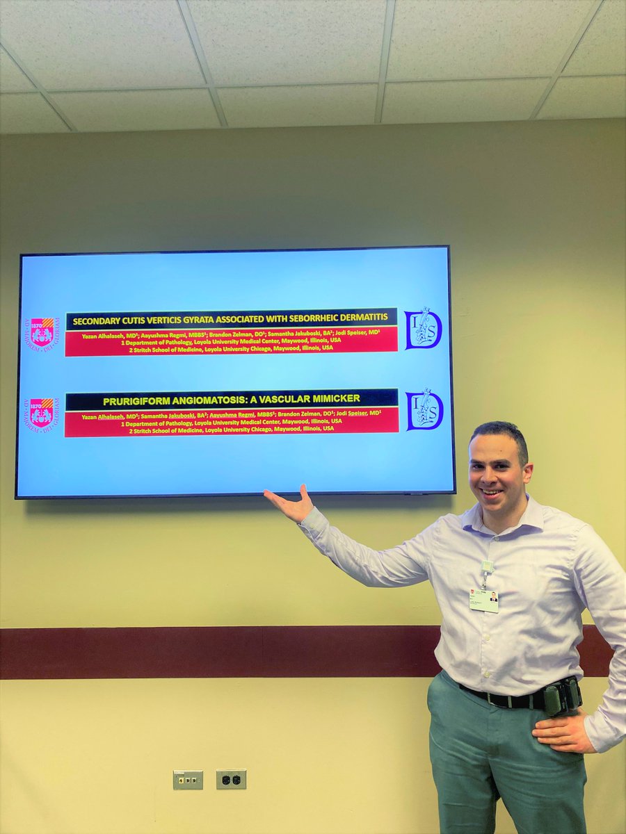 Loyola Dermatopathology (@loyoladermpath) on Twitter photo Wrapping up our oral and poster presentations at #ISDP2022. Excellent work by our residents <a href="/BrandonZelmanDO/">Brandon Zelman, DO</a> <a href="/RegmiAayushma/">Aayushma Regmi</a> <a href="/ElnazPanah/">Elnaz Panah، الناز پناه</a> <a href="/AlhalasehY/">Yazan Alhalaseh</a> Missing <a href="/jason_y_zhu/">Jason Zhu</a> in the frame. Thank you, <a href="/IntSocDermpath/">Int Soc Dermpath</a>, for this platform. <a href="/loyolapathology/">Loyola Pathology & Laboratory Medicine</a> <a href="/JJSpeiserMD/">Jodi Speiser</a> <a href="/eva_wojcik/">Eva Wojcik, MD</a> Wrapping up our oral and poster presentations at #ISDP2022. Excellent work by our residents <a href="/BrandonZelmanDO/">Brandon Zelman, DO</a> <a href="/RegmiAayushma/">Aayushma Regmi</a> <a href="/ElnazPanah/">Elnaz Panah، الناز پناه</a> <a href="/AlhalasehY/">Yazan Alhalaseh</a> Missing <a href="/jason_y_zhu/">Jason Zhu</a> in the frame. Thank you, <a href="/IntSocDermpath/">Int Soc Dermpath</a>, for this platform. <a href="/loyolapathology/">Loyola Pathology & Laboratory Medicine</a> <a href="/JJSpeiserMD/">Jodi Speiser</a> <a href="/eva_wojcik/">Eva Wojcik, MD</a>